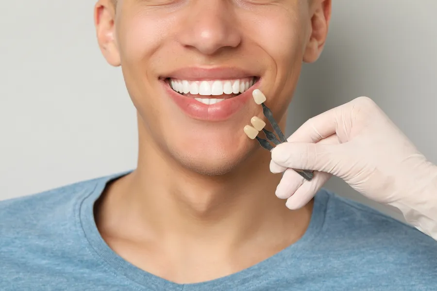Dental shade guide beside a smile