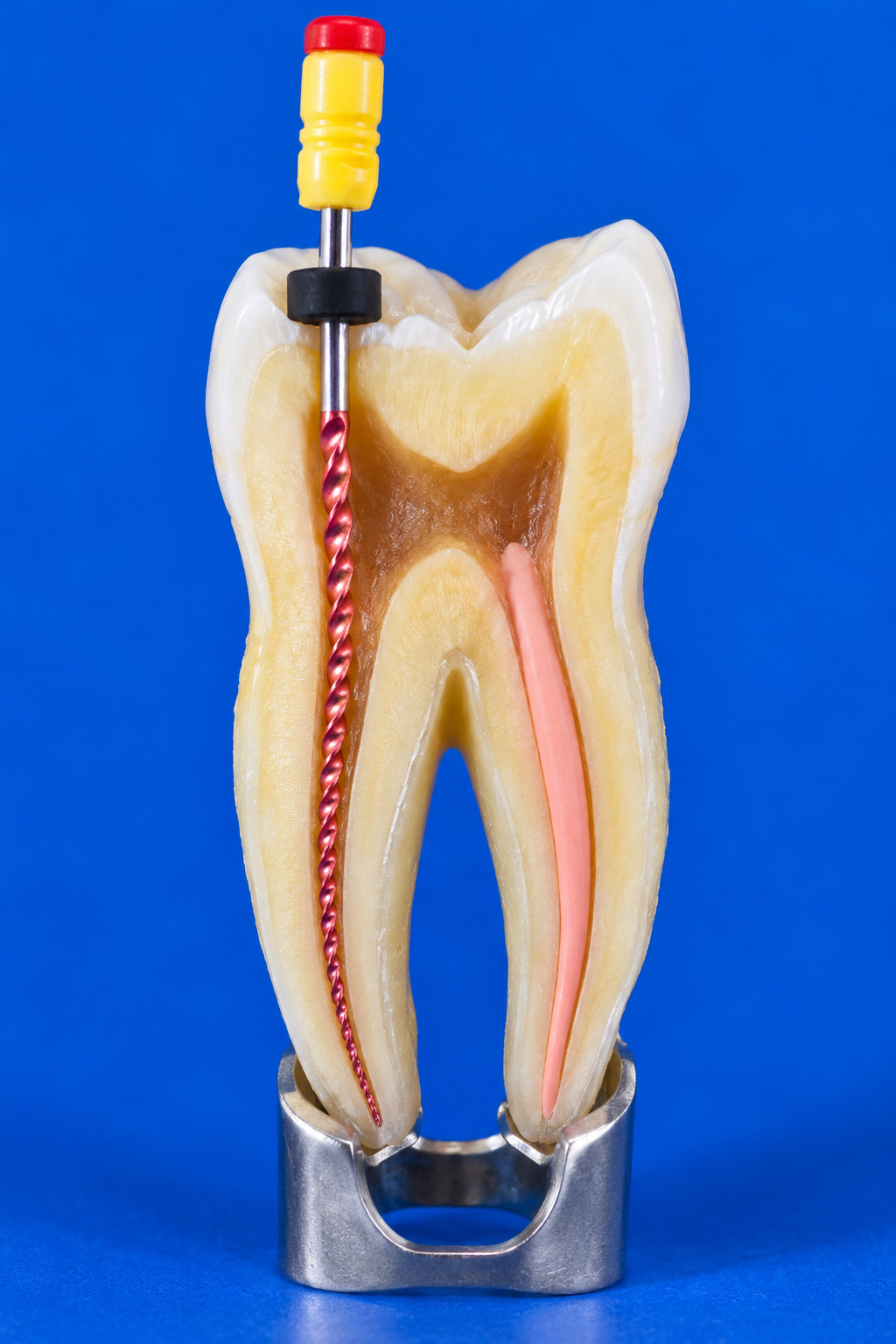 Cross-section tooth model with endodontic file inserted into the root canal